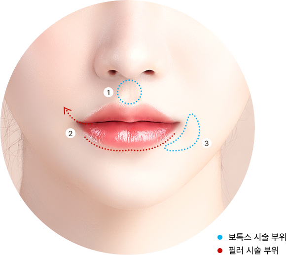 유앤미의원,유앤미클리닉,유앤미,강남유앤미,신논현유앤미,논현유앤미,서울유앤미,서울피부과,서울클리닉,한국피부과,인중축소시술,인중보톡스,입술필러,입술필러잘하는곳,입술필러후기,강남입술필러,강남입술필러잘하는곳,강남쁘띠시술,강남성형잘하는곳,강남시술잘하는곳,입술필러후기,30대입술필러,20대입술필러,입술필러맛집