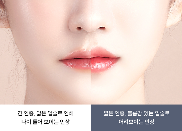 유앤미의원,유앤미클리닉,유앤미,강남유앤미,신논현유앤미,논현유앤미,서울유앤미,서울피부과,서울클리닉,한국피부과,인중축소시술,인중보톡스,입술필러,입술필러잘하는곳,입술필러후기,강남입술필러,강남입술필러잘하는곳,강남쁘띠시술,강남성형잘하는곳,강남시술잘하는곳,입술필러후기,입술필러맛집,인플루언서피부과