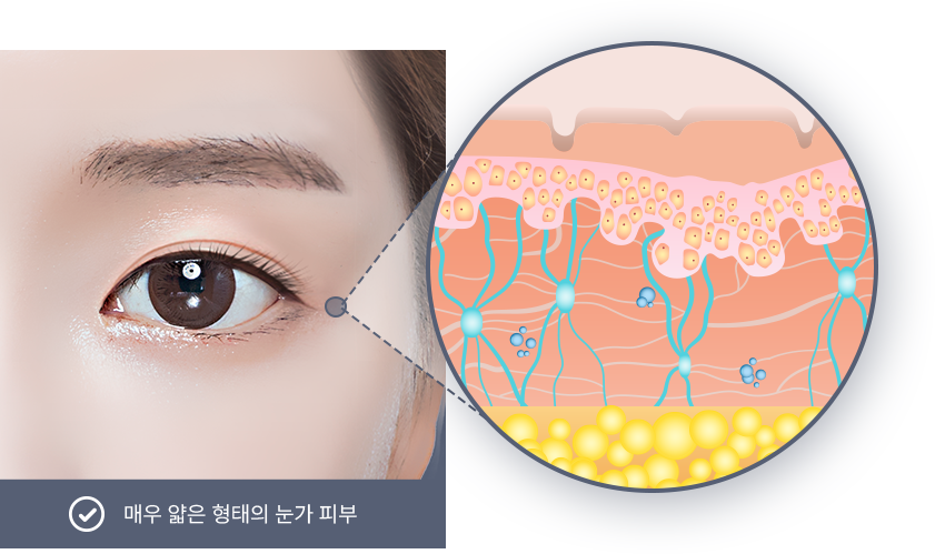 유앤미의원,유앤미클리닉,유앤미,강남유앤미,신논현유앤미,논현유앤미,서울유앤미클리닉,서울피부과,서울클리닉,한국피부과,눈꼬리리프팅,눈매교정잘하는곳,강남눈매교정,강남쌍커플수술,쌍커플수술잘하는곳,안검하수교정,눈밑지방재배치,눈매교정가격,강남얼굴리프팅,강남실리프팅잘하는곳,실리프팅