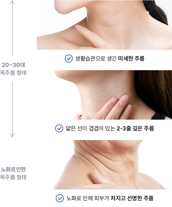 유앤미의원,유앤미클리닉,유앤미,강남유앤미,신논현유앤미,논현유앤미,서울유앤미클리닉,서울피부과,서울클리닉,한국피부과,목주름시술,목주름관리법,가로목주름,세로목주름,목주름,목주름팩,목주름필러,목주름레이저,목주름크림,20대목주름,30대목주름,40대목주름,50대목주름,히알루론산필러,울쎄라리프팅,울쎄라목주름,울쎄라,목주름스킨보톡스,슈링크유니버스