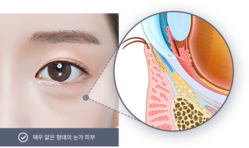 유앤미의원,유앤미클리닉,유앤미,강남유앤미,신논현유앤미,논현유앤미,서울유앤미클리닉,서울피부과,서울클리닉,한국피부과,눈밑꺼짐필러,눈밑꺼짐리프팅,눈밑꺼짐시술,강남눈성형,강남쌍커플수술,애교살필러,실리프팅잘하는곳,실리프팅,다크써클,다크써클필러,눈밑지방재배치,눈밑지방제거,안검하수교정,눈매교정시술