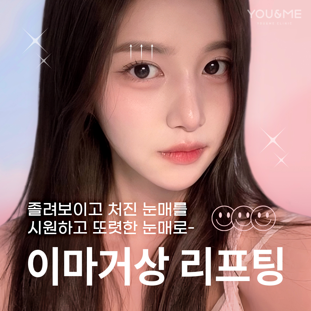 이마거상리프팅,이마거상,눈매교정,눈썹교정,안검하수,안검하수수술,실리프팅,이마리프팅,이마보톡스, 미간보톡스,주름보톡스,실리프팅,실리프팅후기.안검하수